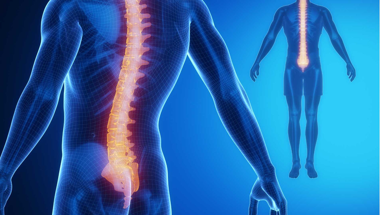 tout savoir sur la syringomyélie 